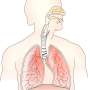 Exhaled breath analysis shows promise in detecting malignant pleural mesothelioma