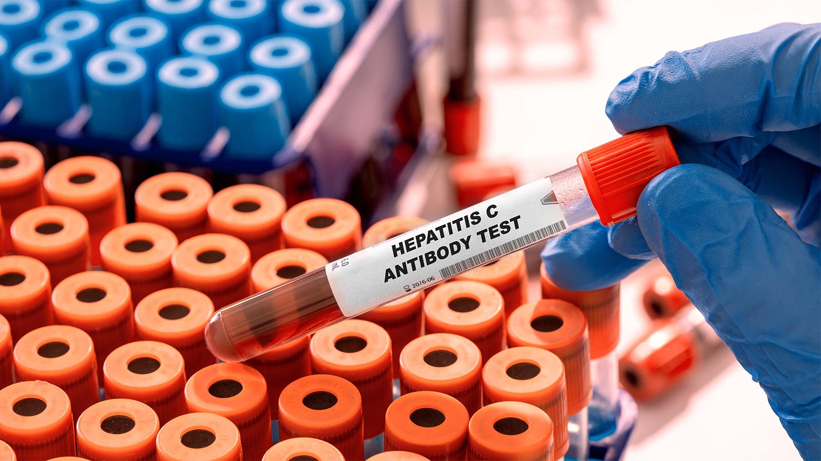 CDC Backs Hepatitis C Screening for Kids Exposed in the Womb