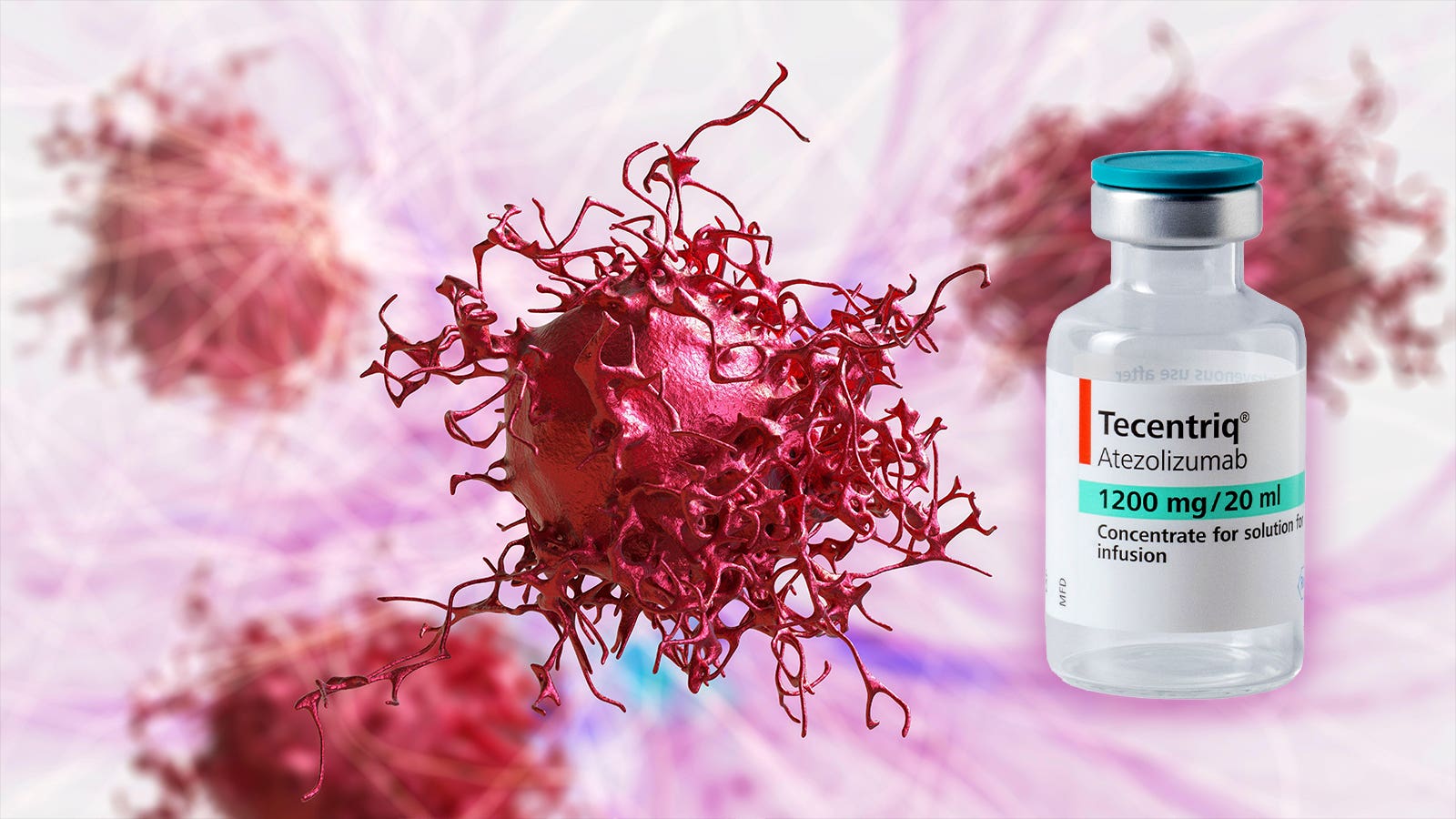 Adding Atezolizumab Improves Survival in Advanced Cervical Cancer