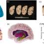 New computer tools can reconstruct 3D brain from biobank photos
