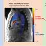 Unstable ‘fluttering’ predicts aortic aneurysm with 98% accuracy