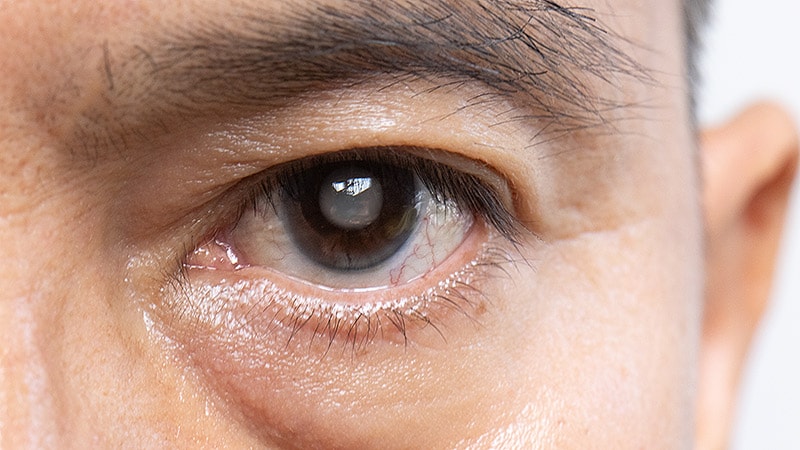 Selective Antibiotic Prophylaxis Improves Eye Surgery Safety